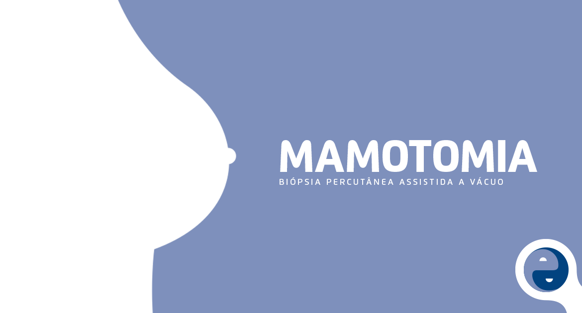 Mamotomia