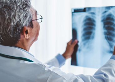 Tudo o que você precisa saber sobre a saúde dos pulmões
